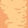 Celulitis